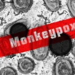 MSC Noticias Latinoamerica - monkey-pox-7217582_1280-150x150 Salud Ultimas Noticias 